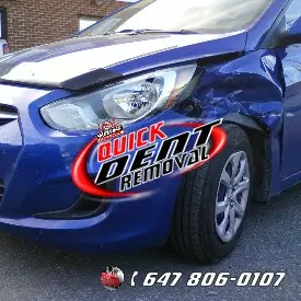 Quick Dent Removal Services - Toronto - GTA | Mobile Paintless Dent Repair